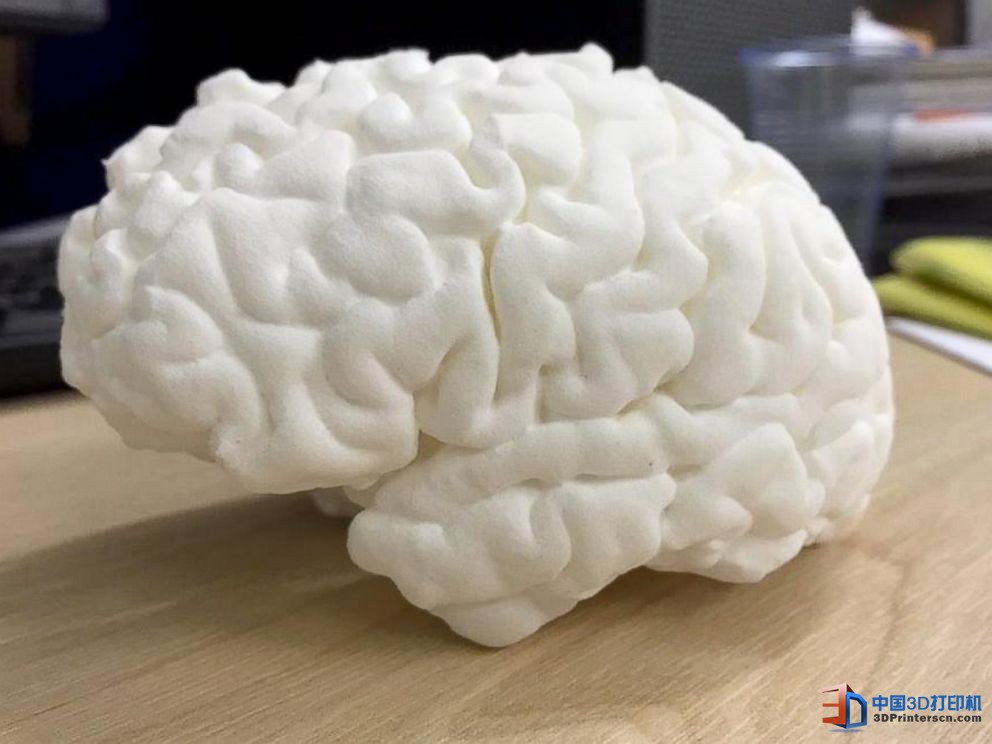 未來醫(yī)療行業(yè) 3D打印技術(shù)融入其中的四種方式

3D醫(yī)療行業(yè),3D打印心臟,3D打印大腦,3D打印應(yīng)用,3D打印領(lǐng)域,3D打印和醫(yī)療的關(guān)系,3D打印平臺,3D打印服務(wù),3d打印企業(yè)服務(wù)平臺
