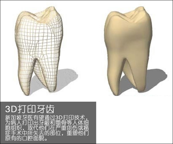 個性化醫(yī)療3D打印實戰(zhàn)案例與研究成果的問答整理_3d打印服務(wù)公司
