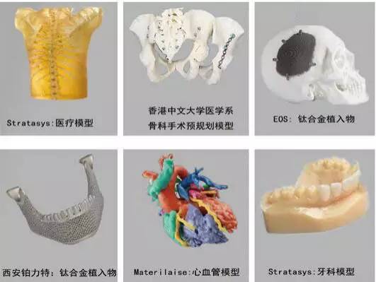 3d打印在醫(yī)療領(lǐng)域的應(yīng)用 3D打印與醫(yī)療行業(yè)白皮書(shū)