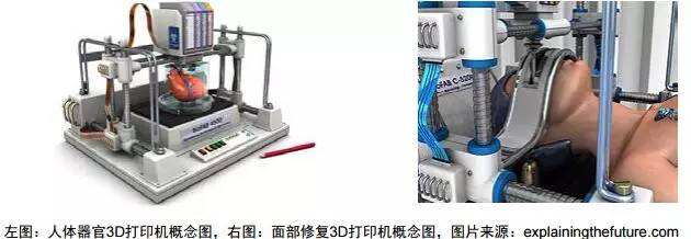 3d打印在醫(yī)療領(lǐng)域的應(yīng)用 3D打印與醫(yī)療行業(yè)白皮書(shū)